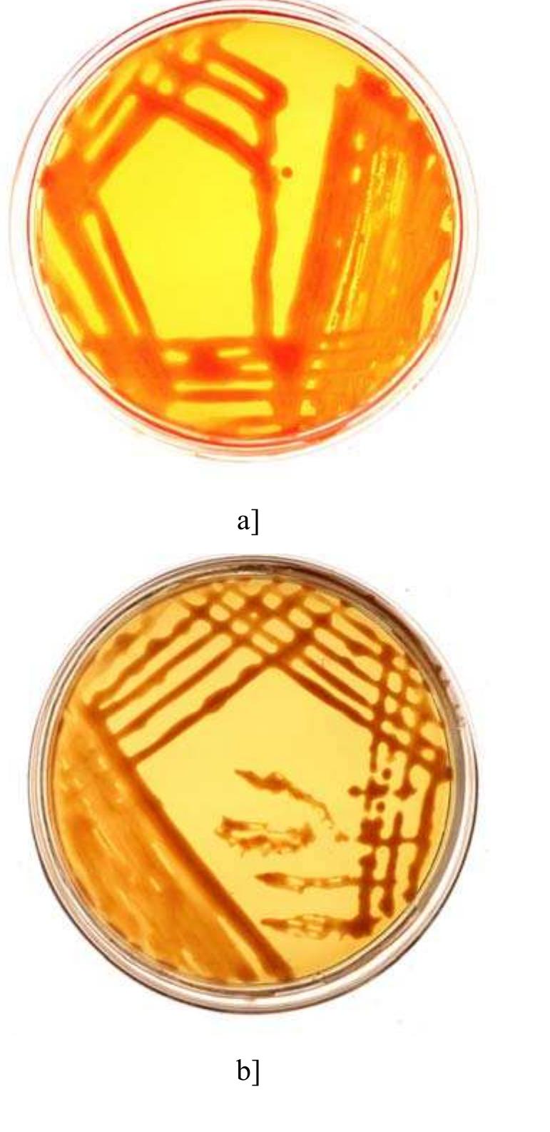 Mucoid, glistening colony morphology of a] vagococcus