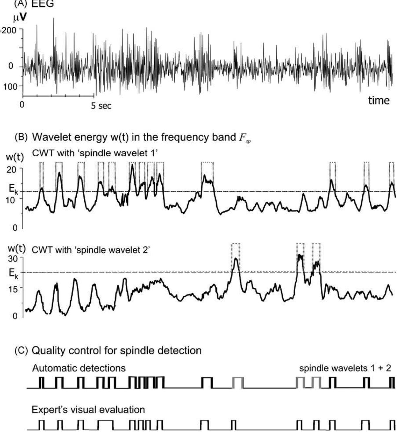 (PDF) Sleep spindles and spike–wave discharges in EEG: Their generic ...