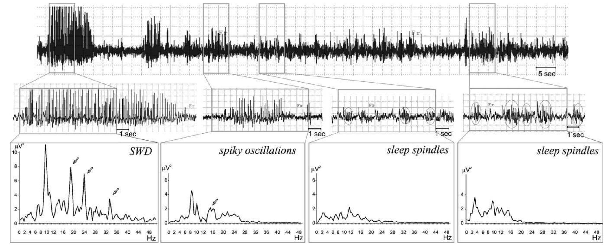 (PDF) Sleep spindles and spike–wave discharges in EEG: Their generic ...