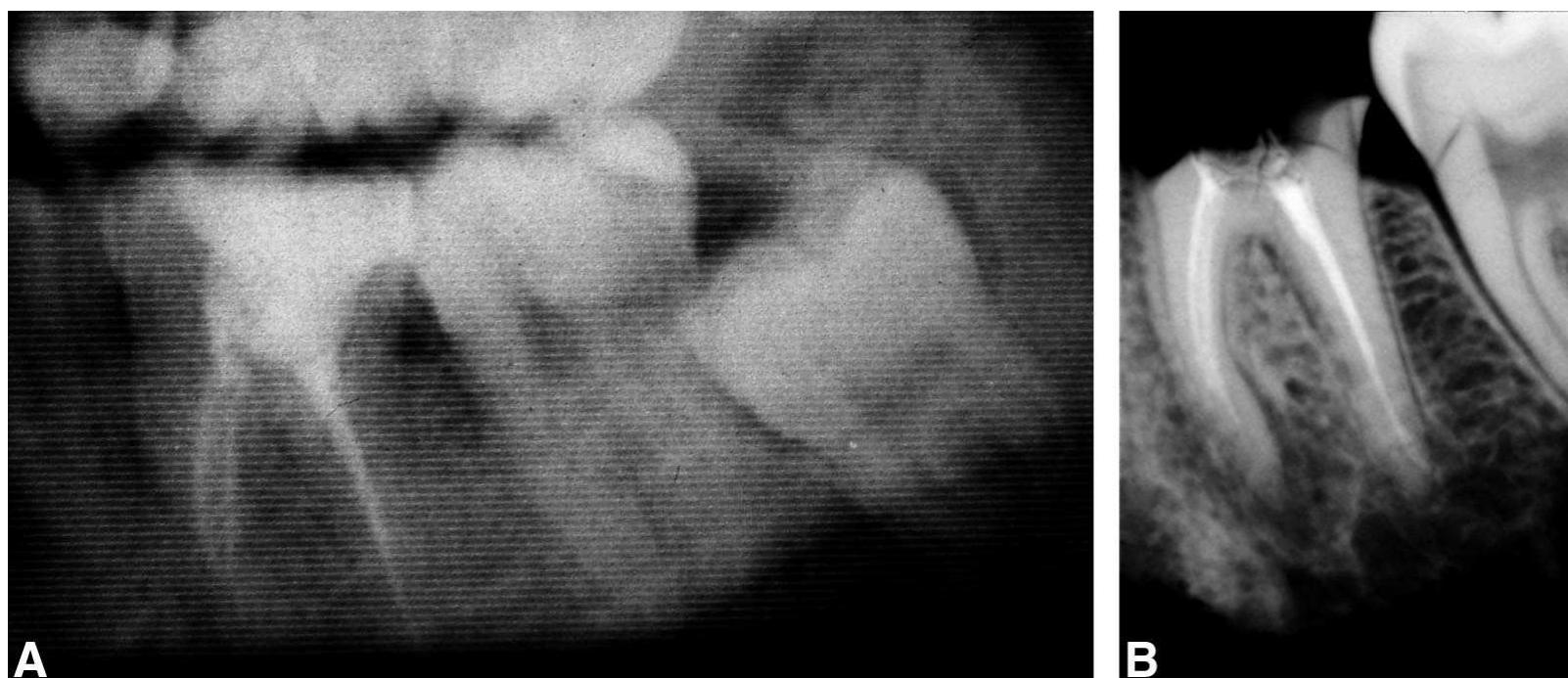 (PDF) Craniofacial Identification by Comparison of Antemortem and ...