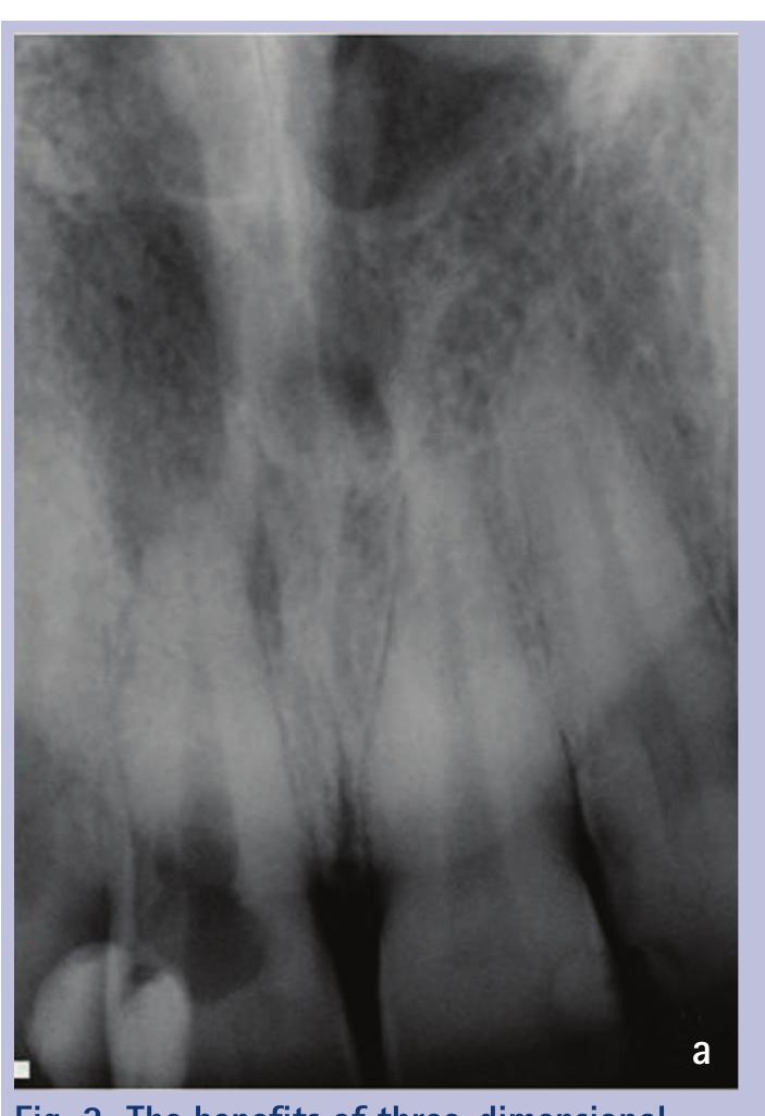 (PDF) Cone beam CT in dental practice