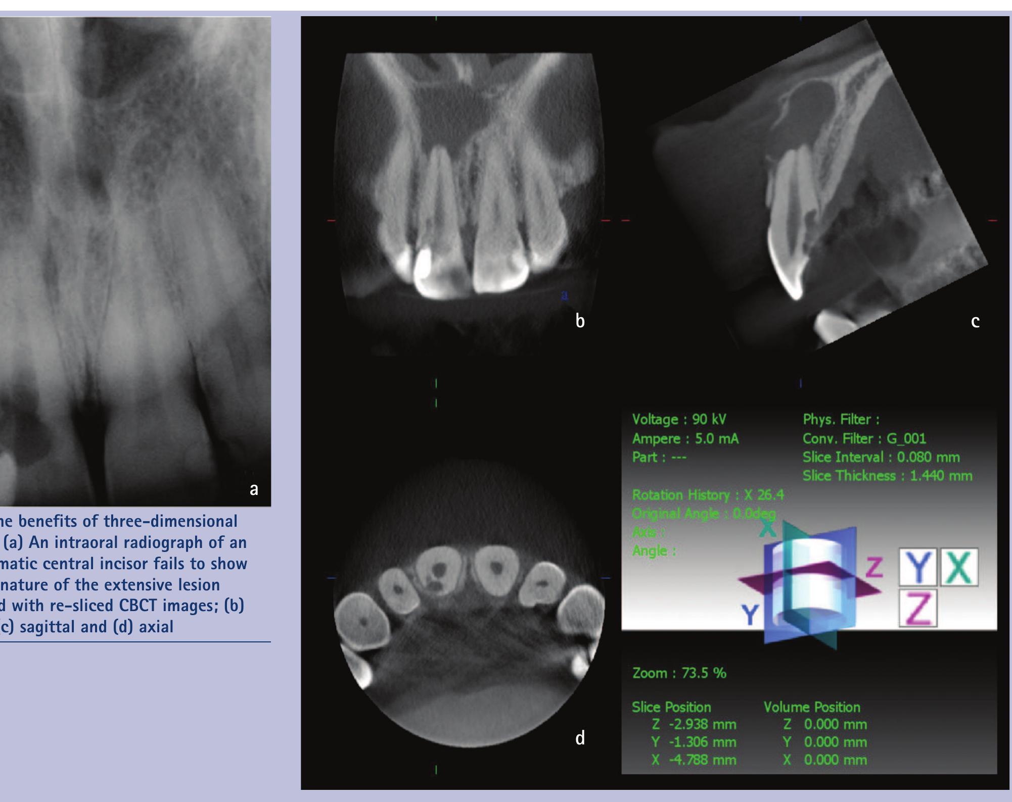 (PDF) Cone beam CT in dental practice