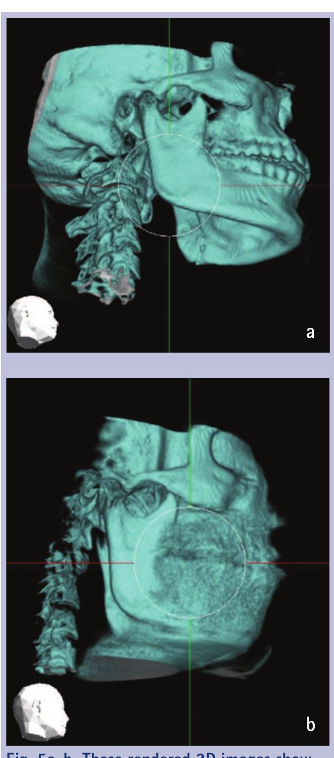 (PDF) Cone beam CT in dental practice
