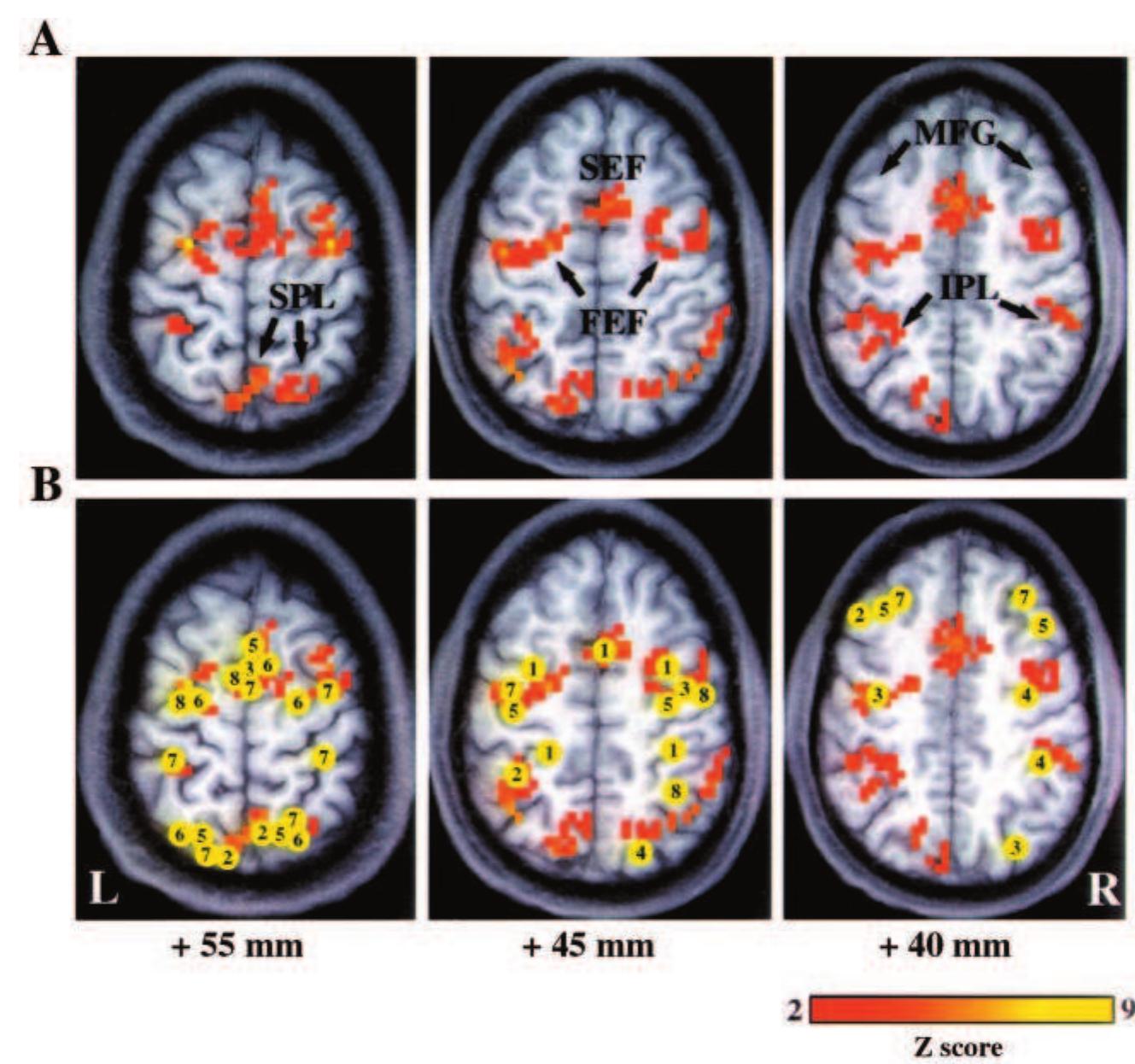 (PDF) Mechanisms of Visual Attention in the Human Cortex