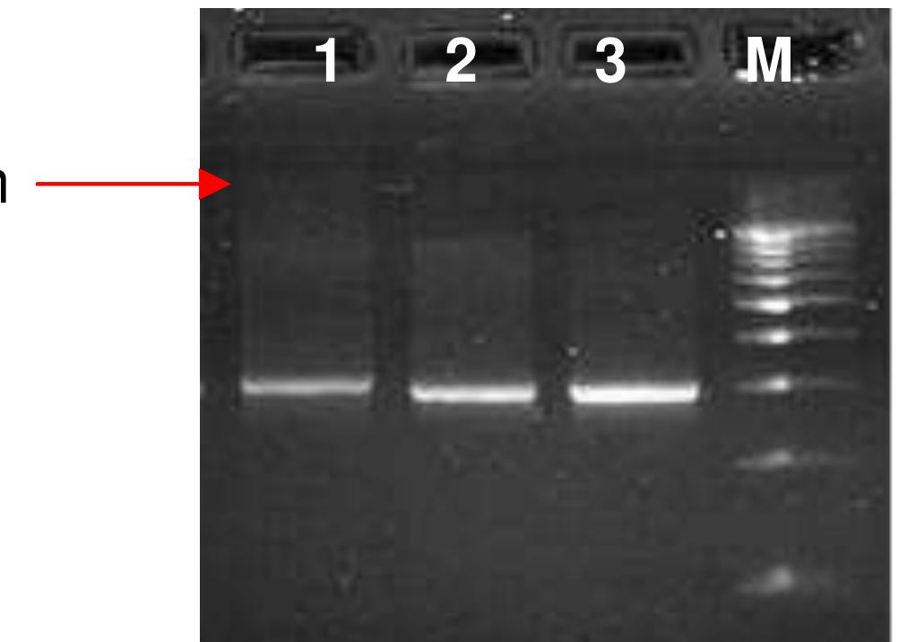 “ALOHA”OG(9TO 1ml) PDF) CTX-M from community-acquired urinary tract infections