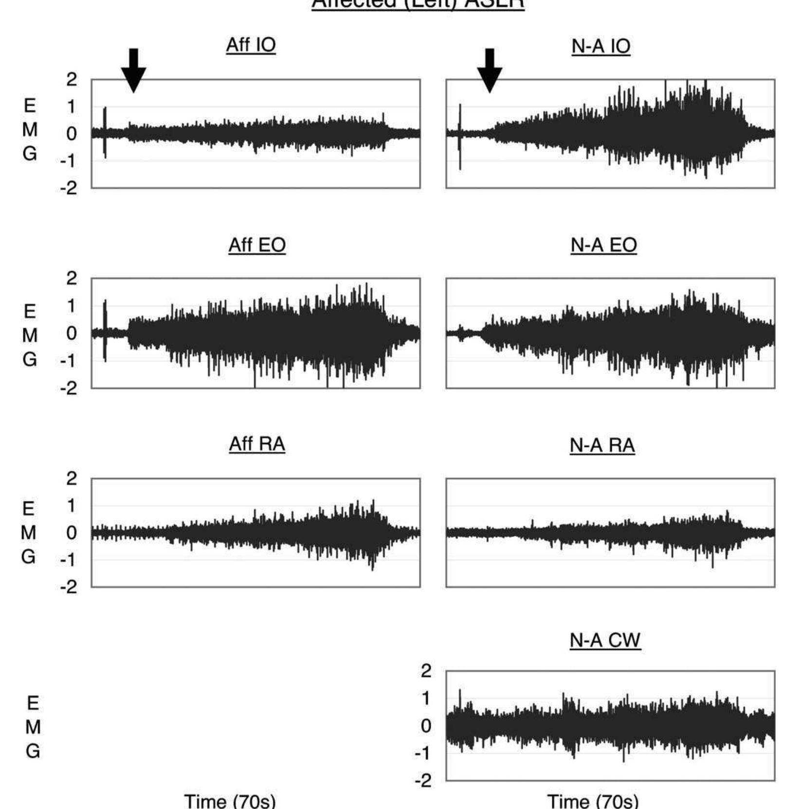 (PDF) The effects of manual pelvic compression on trunk motor control ...