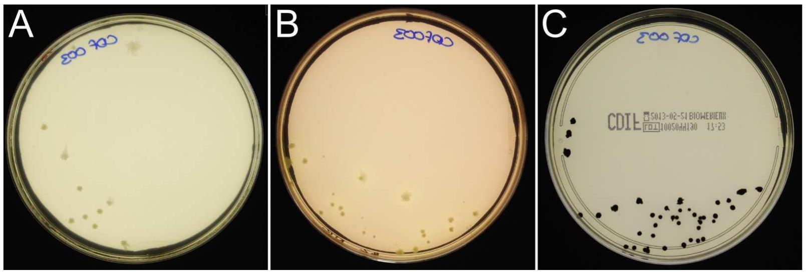 (PDF) Comparison of culture based methods for the isolation of ...