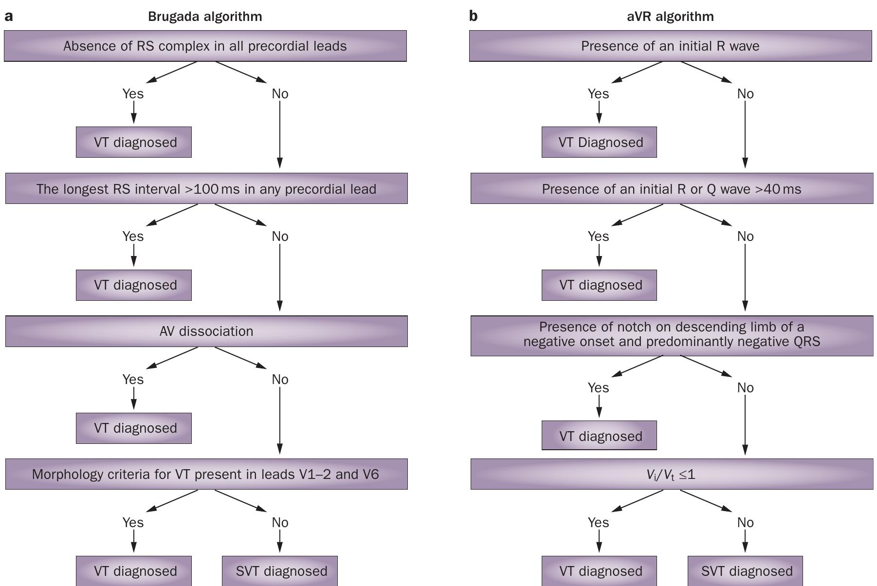 (PDF) The diagnosis and management of ventricular arrhythmias