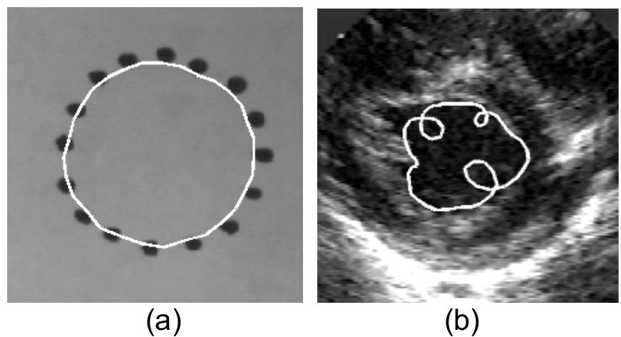(PDF) Application of an active contour model for extraction of fuzzy ...