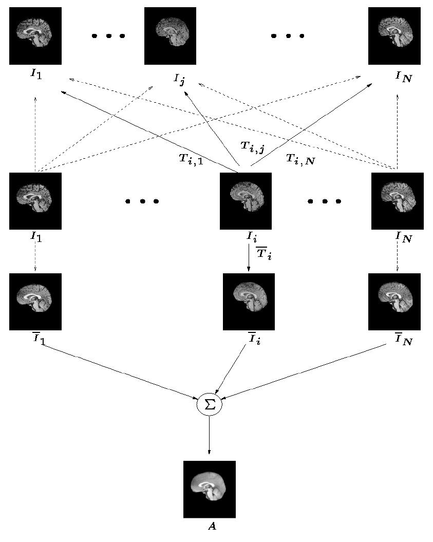 (PDF) Construction of a Brain Template from MR Images Using State-of ...