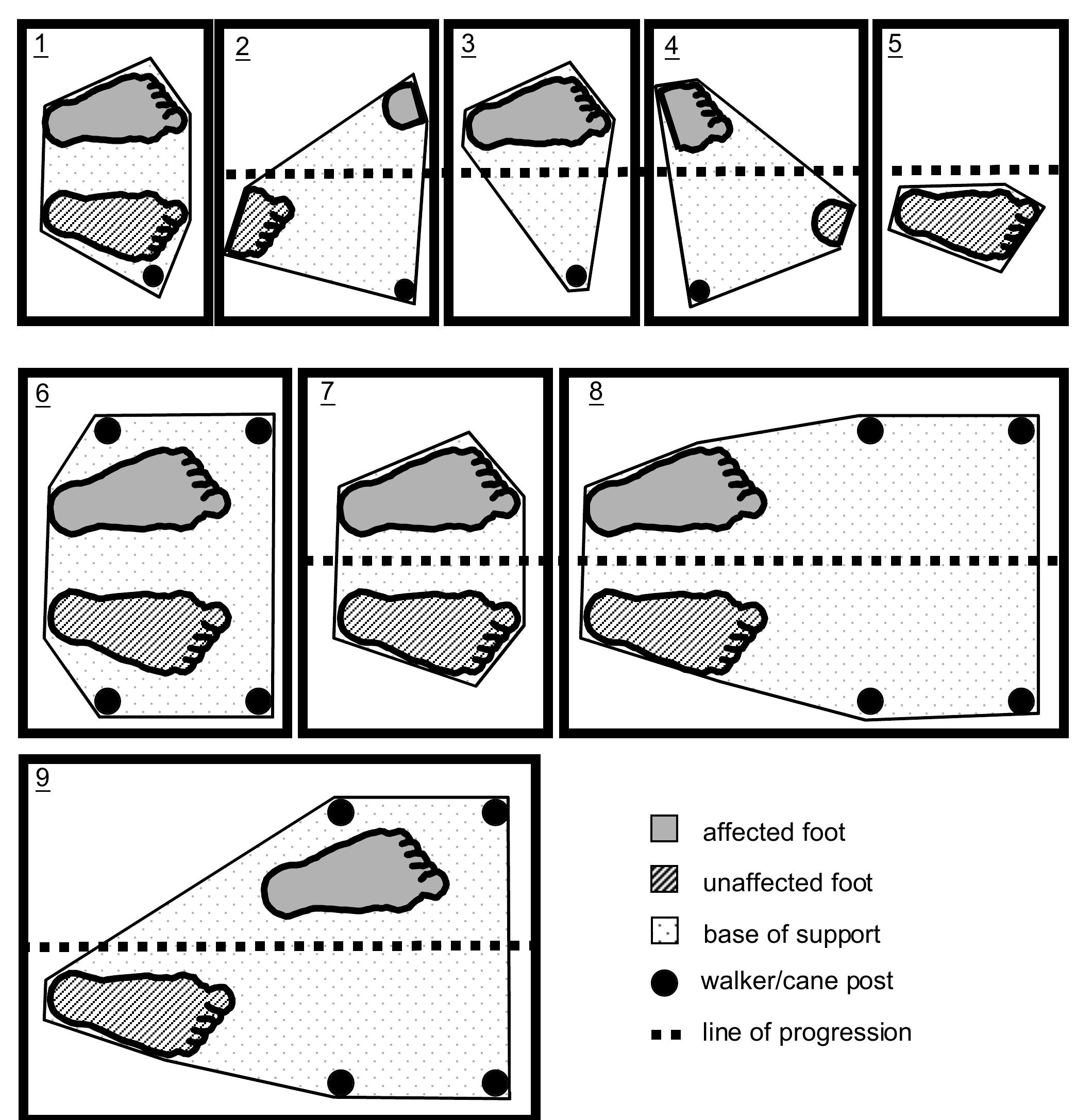 Free body diagram of a cane illustrating how the force and
