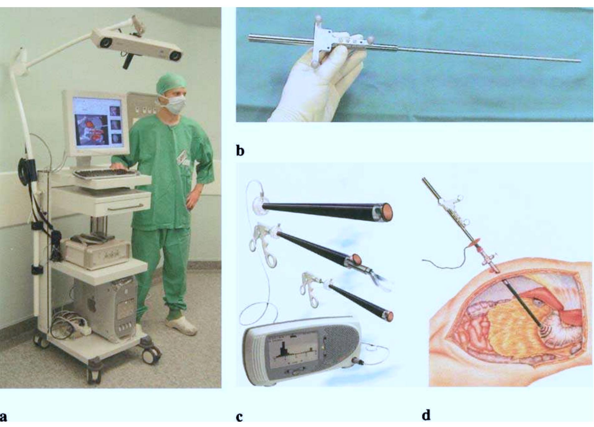 (PDF) Laparoscopic navigation pointer for three-dimensional image ...