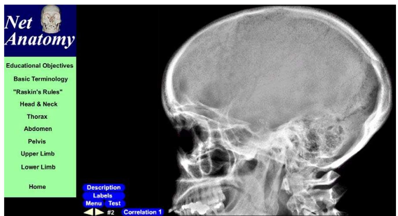 Plural Sign Radiograph (PDF) Web watch: radiographic anatomy on the web