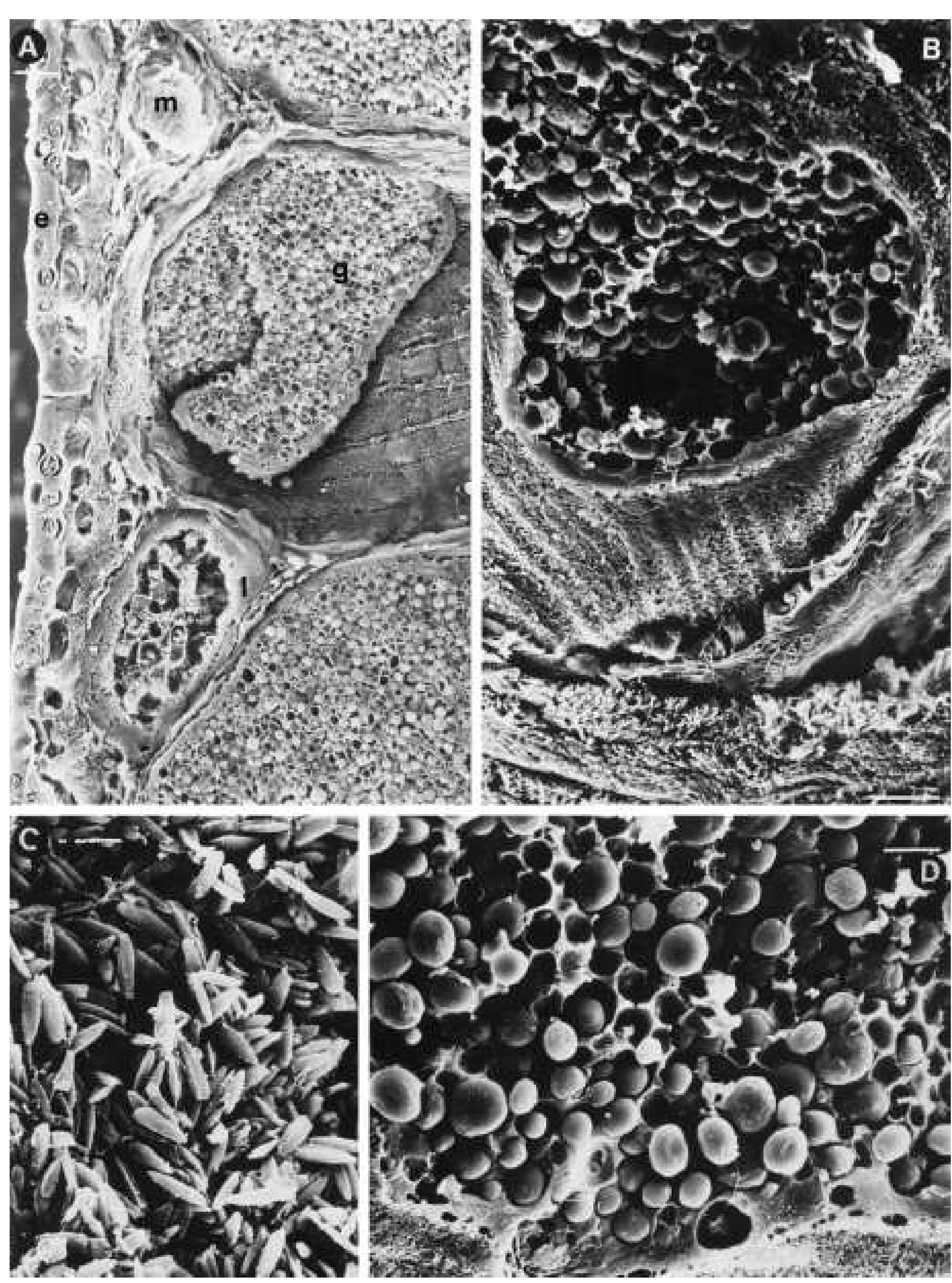A: electron micrograph showing the organization of the