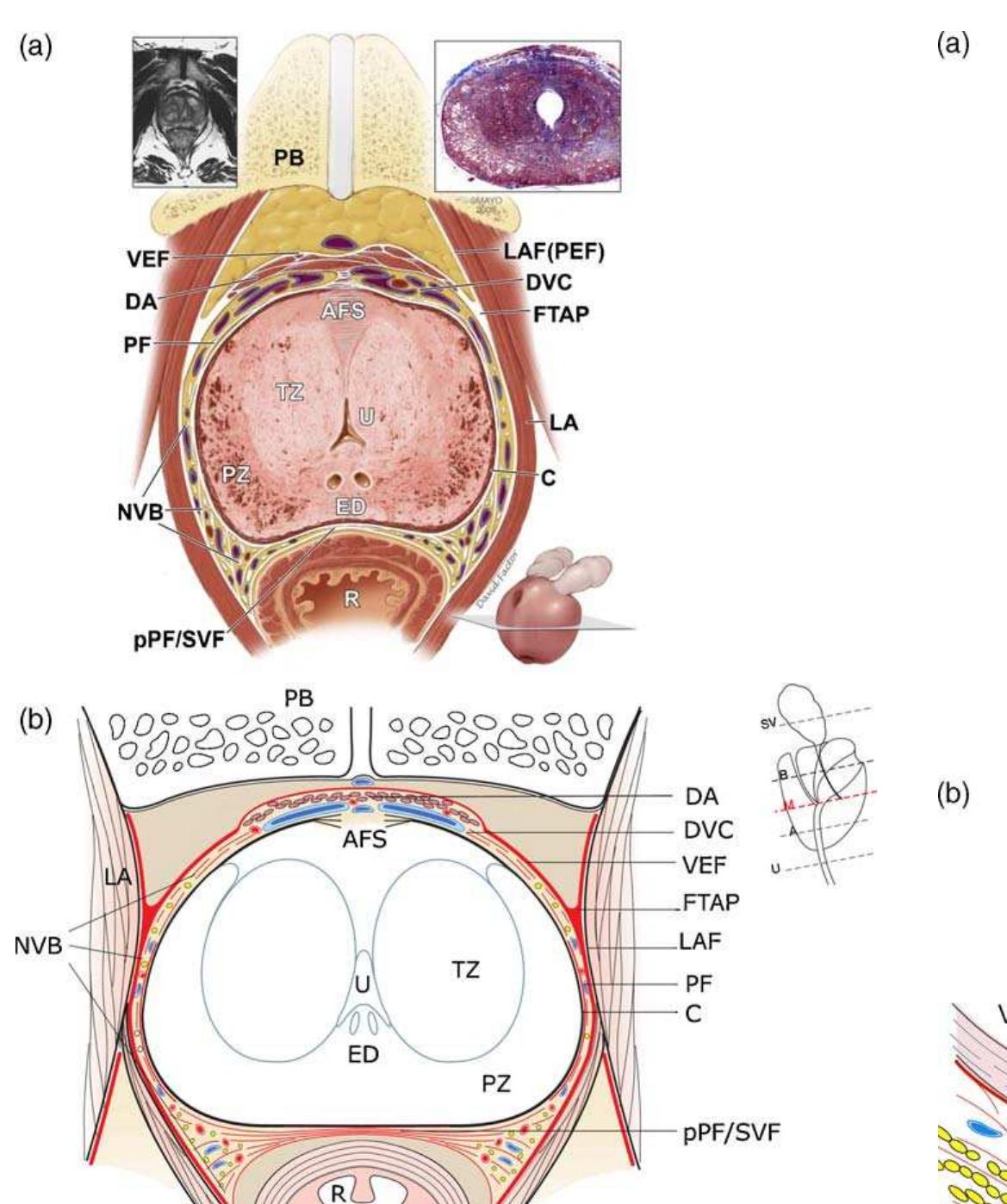 - axial section of prostate and periprostatic fascias at