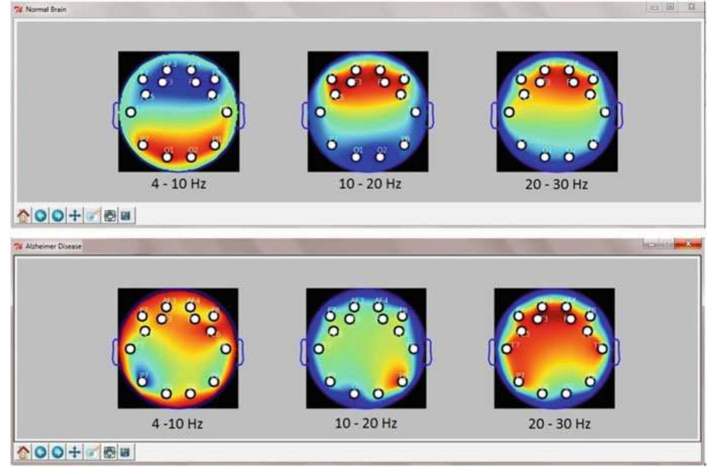10 topoplot demonstration of eeg signals in healthy subject