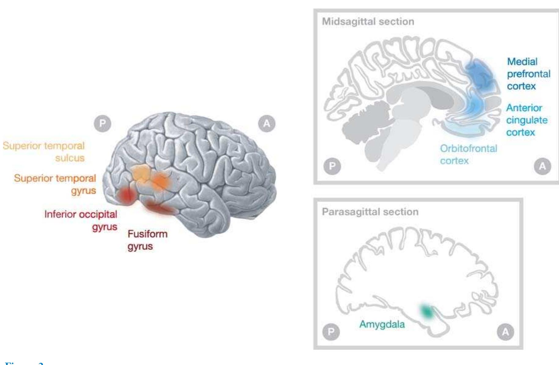 (PDF) AUTISM: A Window Onto the Development of the Social and the ...