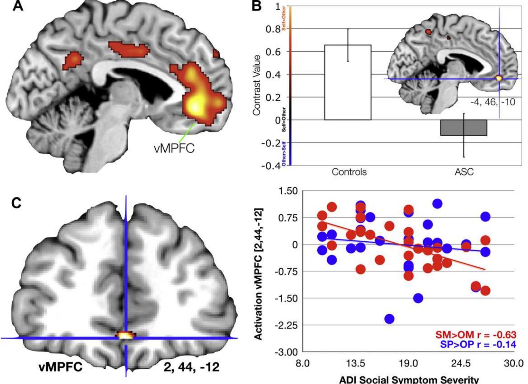 (PDF) The role of the self in mindblindness in autism