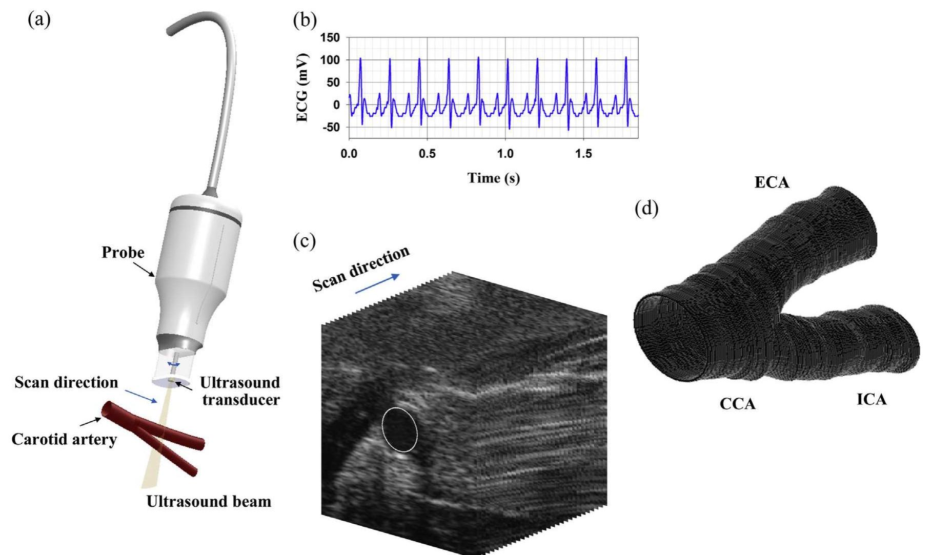(PDF) 3D reconstruction of a carotid bifurcation