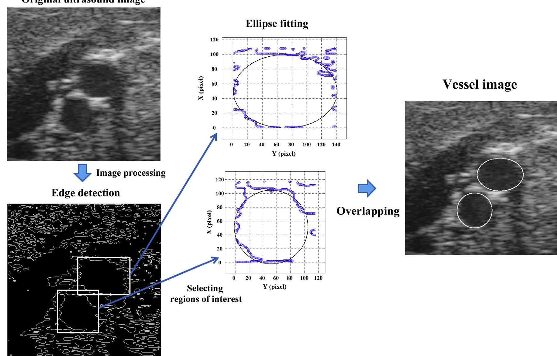 (PDF) 3D reconstruction of a carotid bifurcation