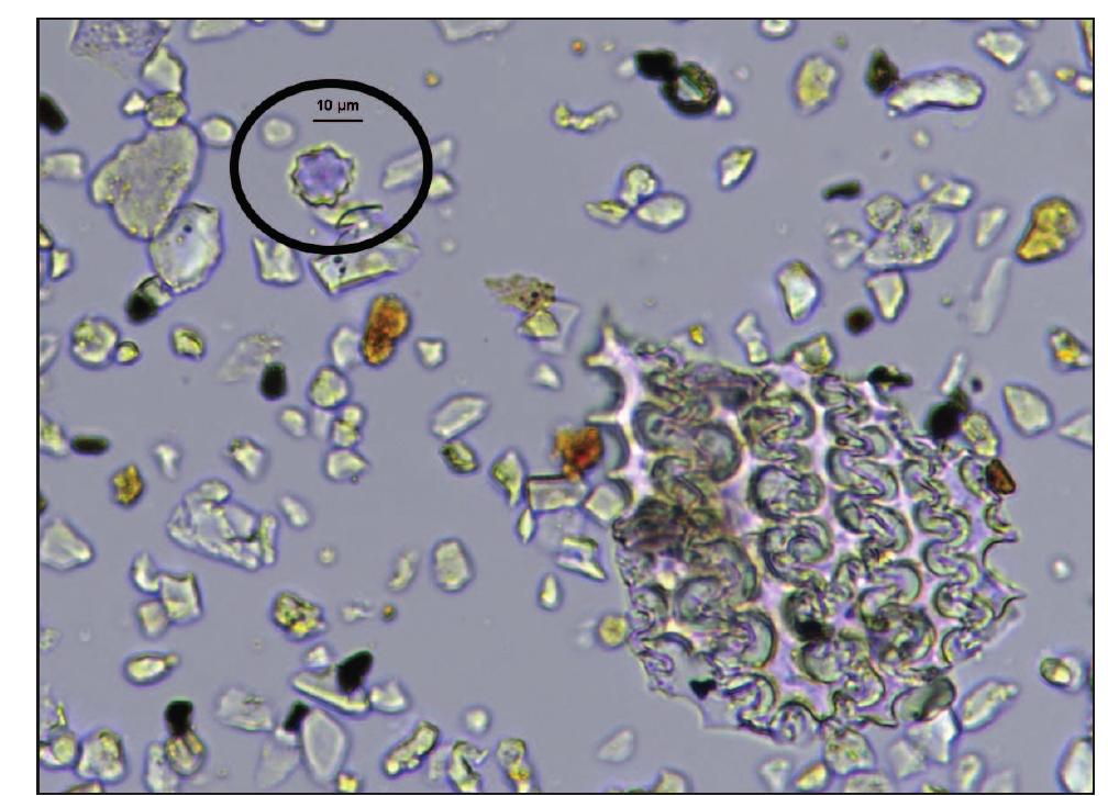Figure 20. Date palm phytolith (circled) with grass husk (possibly barley) from Sample ND-14-9 (Trench I, Sample 9).  Phytoliths were extracted using gravity sedimentatior dry-ashing, and heavy liquid floatation. First they wer treated with 10% HCl to remove any calcium carbonates The HCl then was removed by centrifuging. Clays wer removed by first dispersing them with a 5% solutio! of sodium hexametaphosphate and distilled water in| cylinder. Water then was added to a height of 8 cm an allowed to settle for one hour. After this time the suspens: 