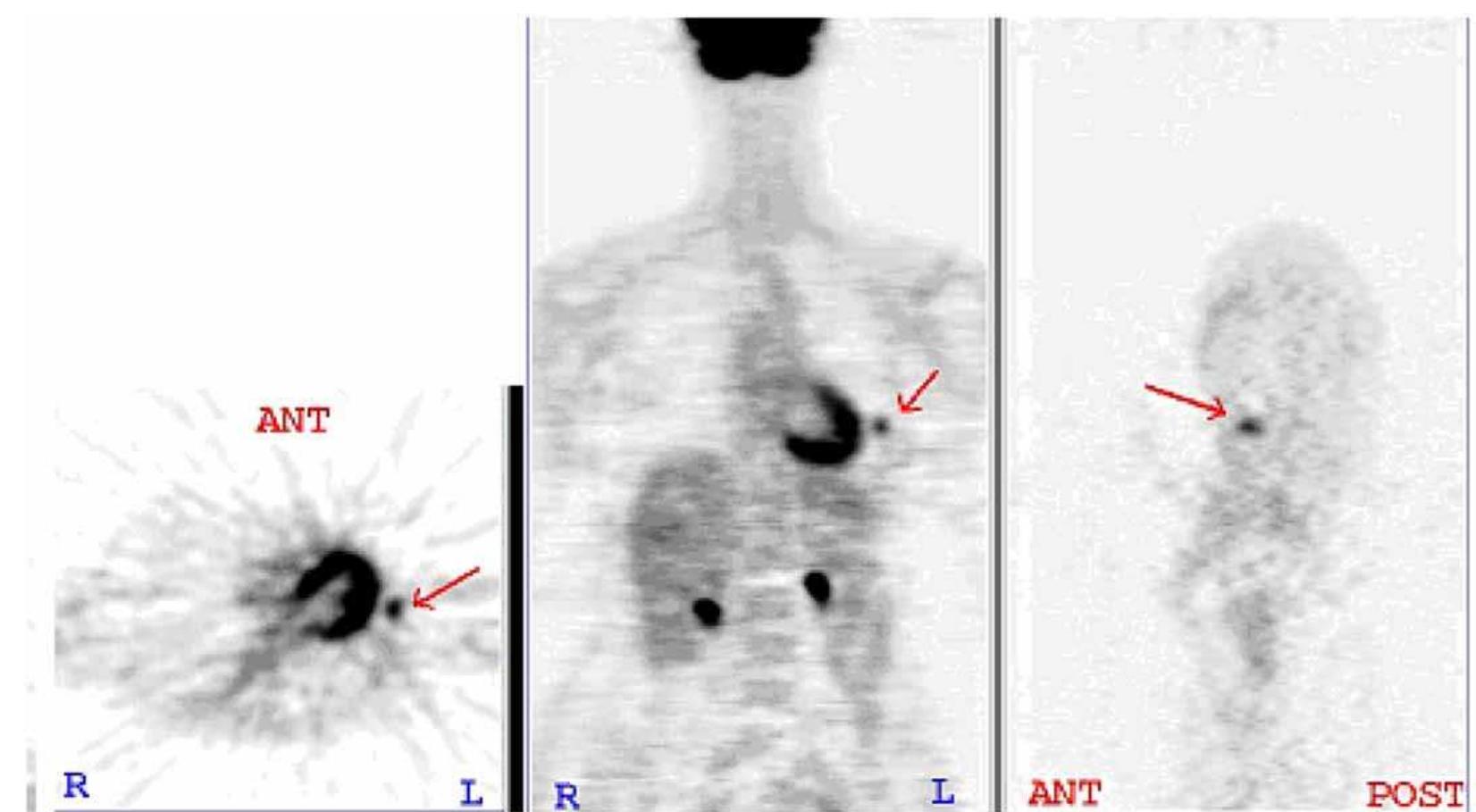 PDF) PET-ARTICLE-SKITSON