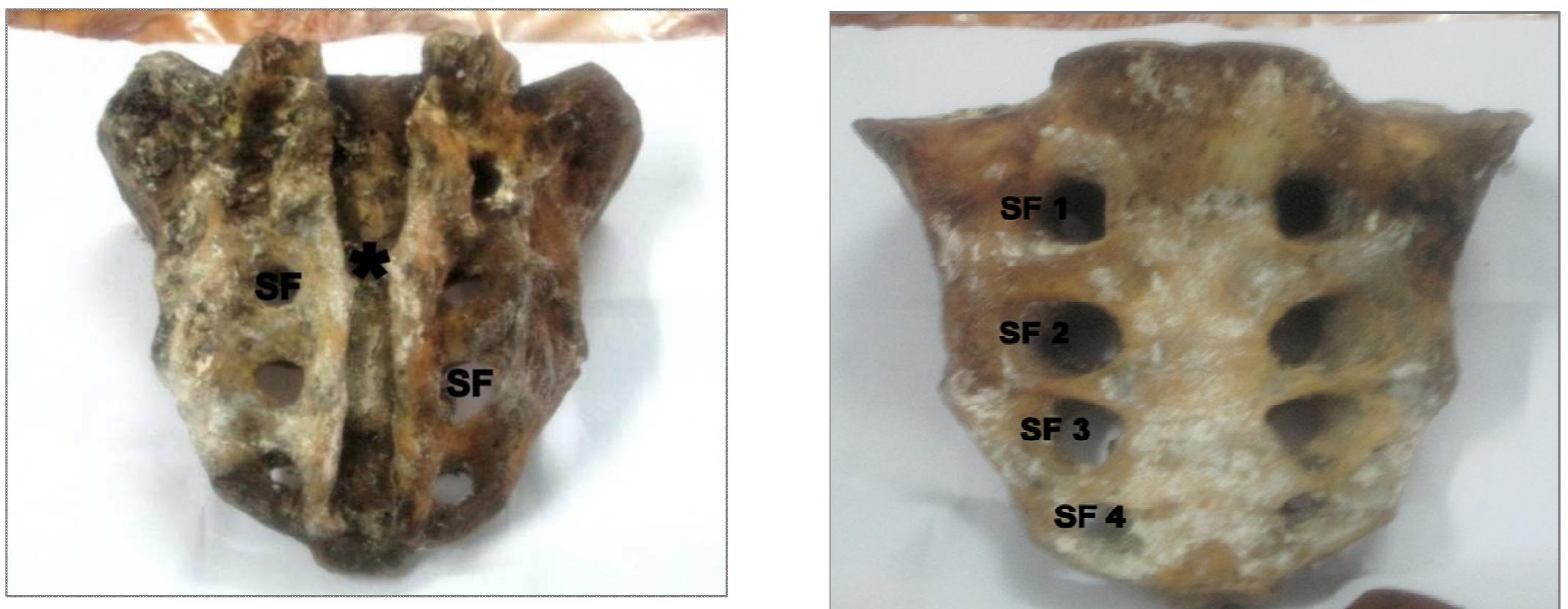 Dorsal surface of sacrum fig .2 ventral surface of the
