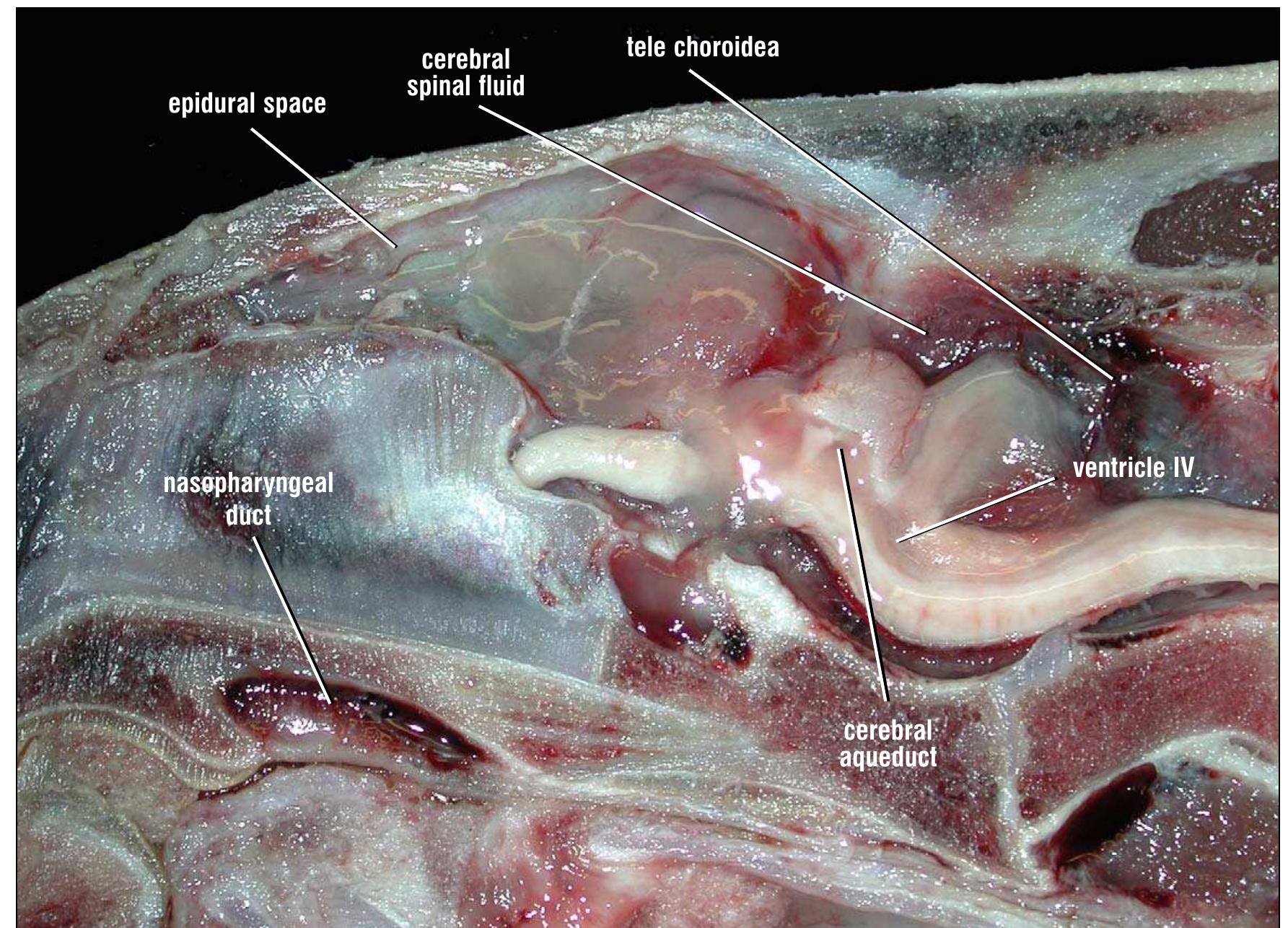 Parasagittal section of the brain and airways. the section