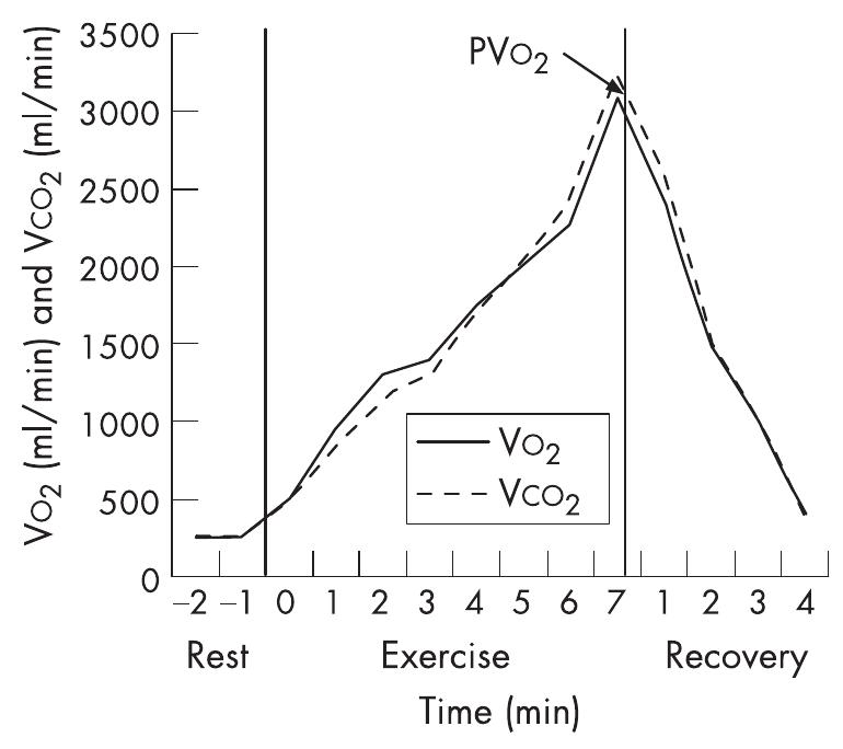 Pvo2 Exercise Setup (PDF) Cardiopulmonary exercise testing and its application