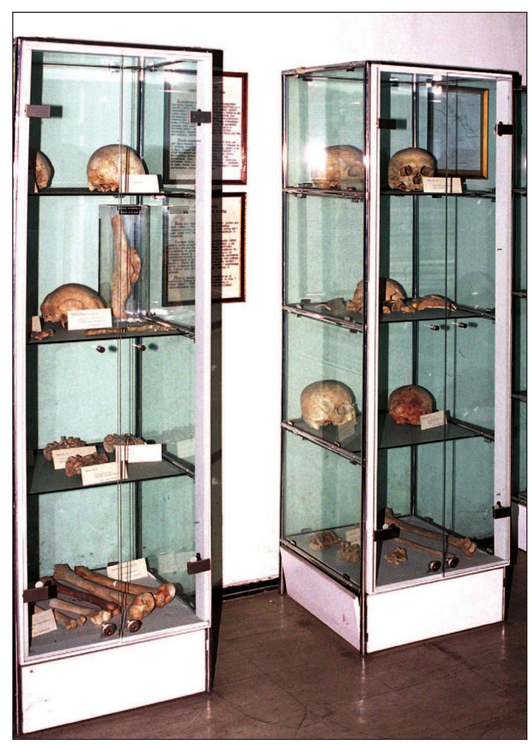 Exhibits of the human pathology collection