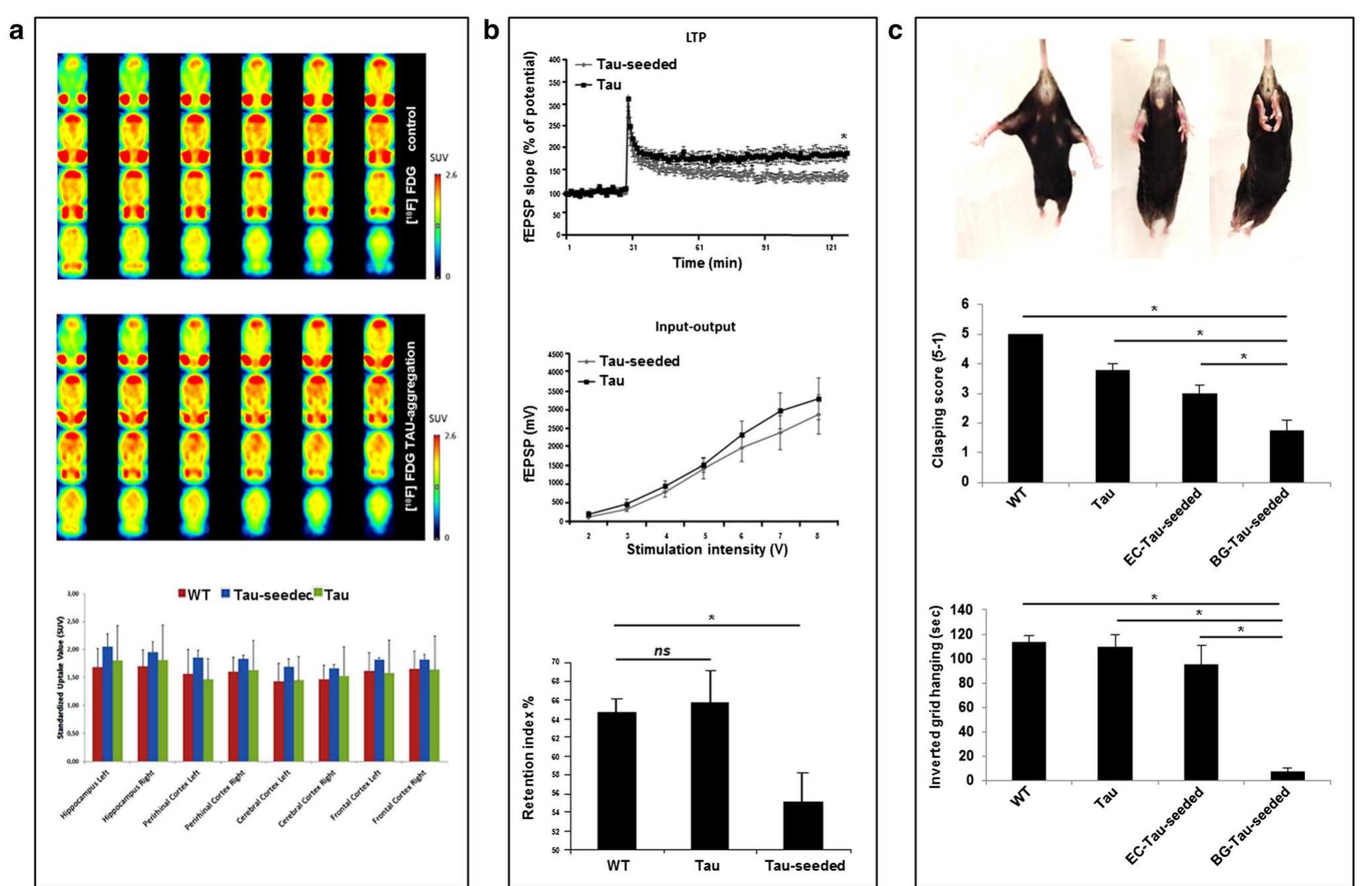 (PDF) Templated misfolding of Tau by prion-like seeding along neuronal ...