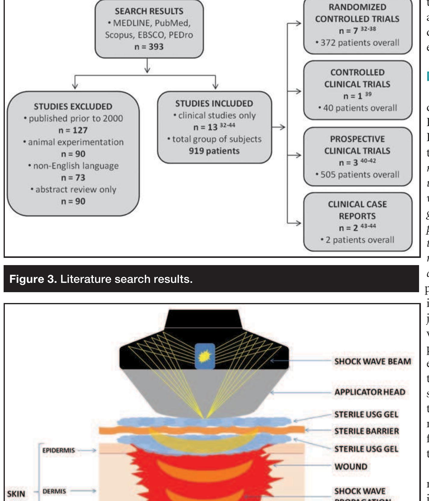 (PDF) Extracorporeal shock wave therapy as an adjunct wound treatment ...