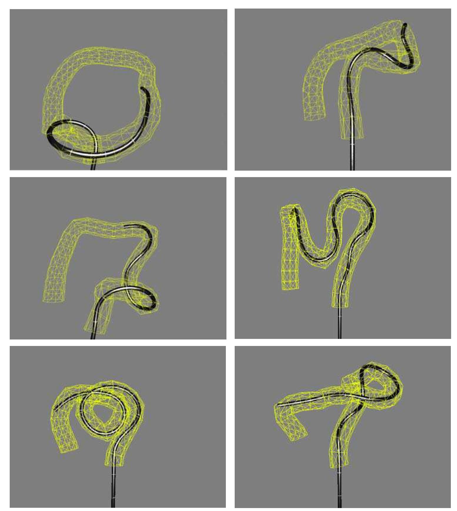 (PDF) DEVELOPING A NEXT GENERATION COLONOSCOPY SIMULATOR