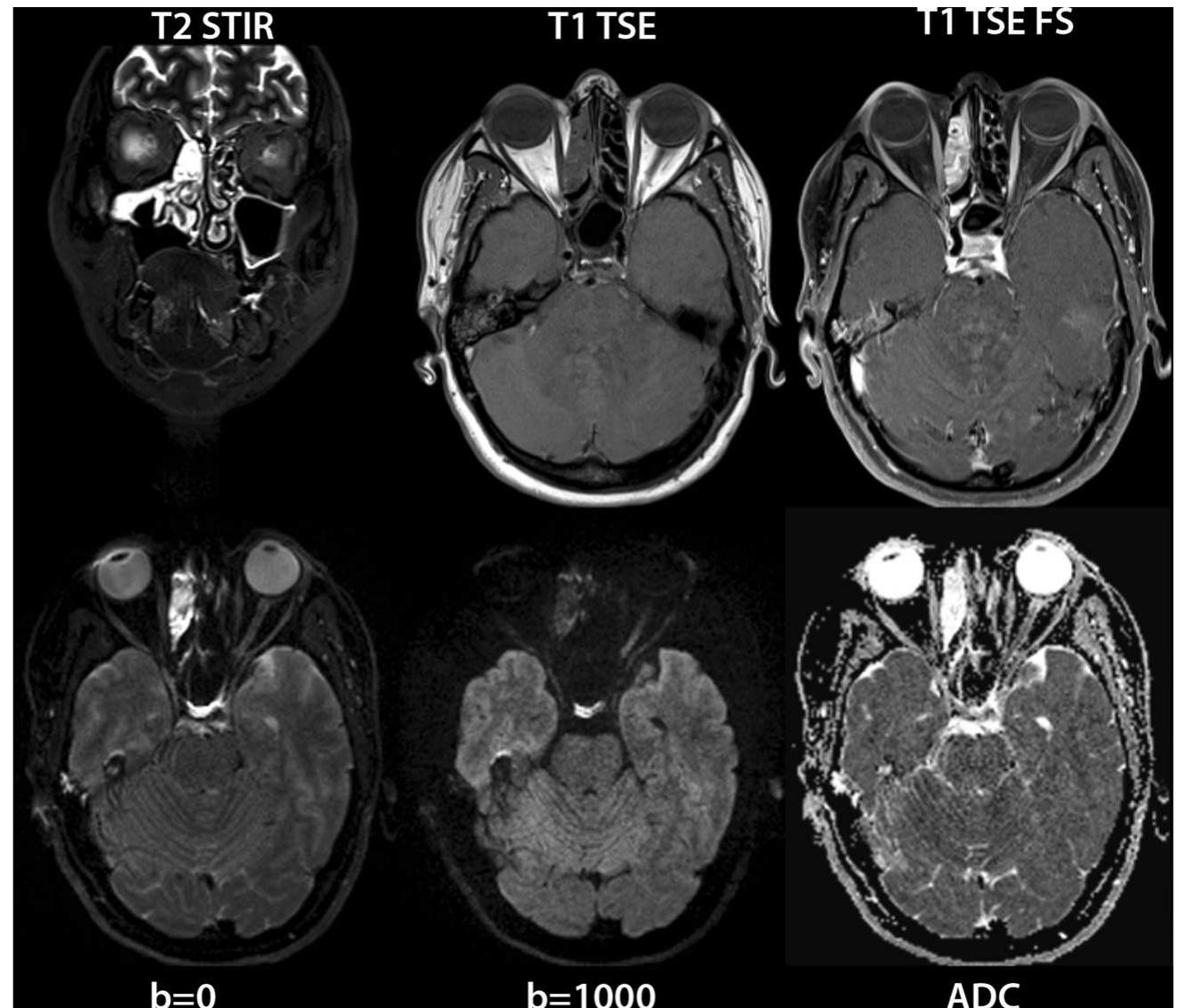 (PDF) State-of-the-art MRI techniques in neuroradiology: principles ...