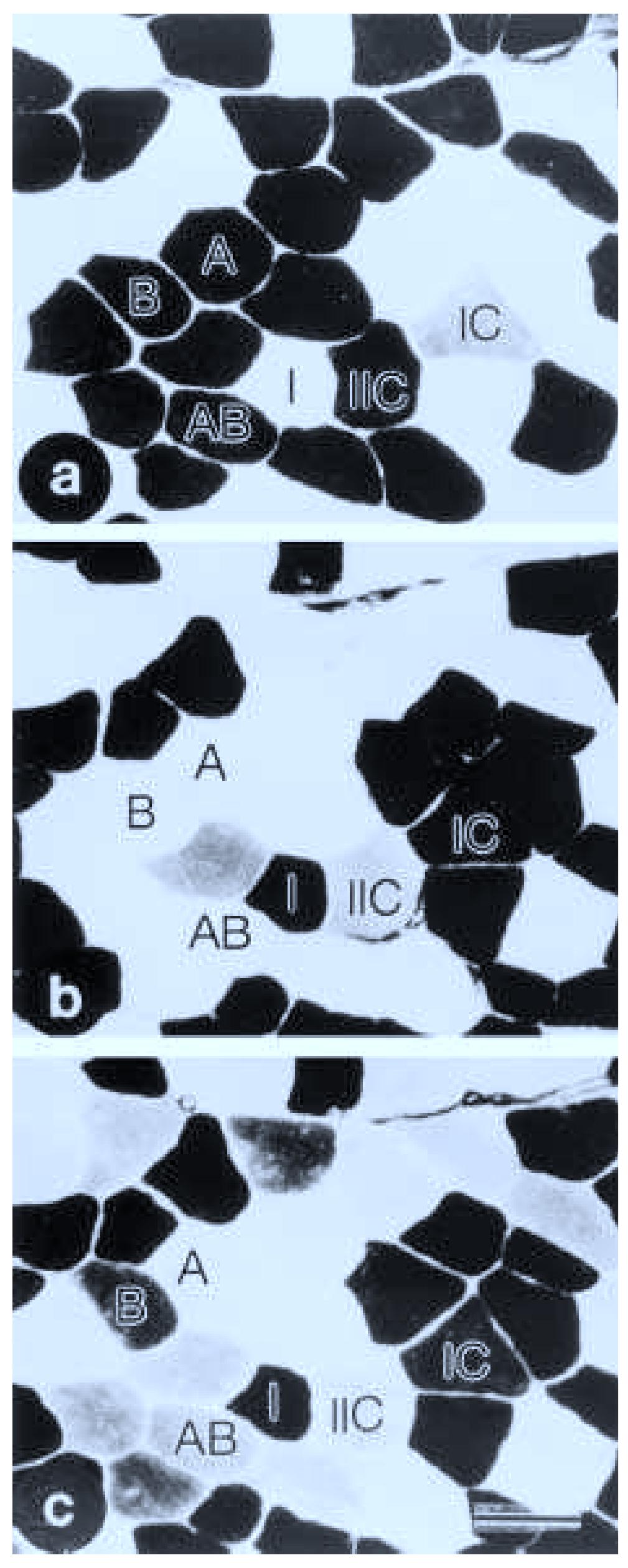 Serial cross-sections of a pretraining muscle sample taken
