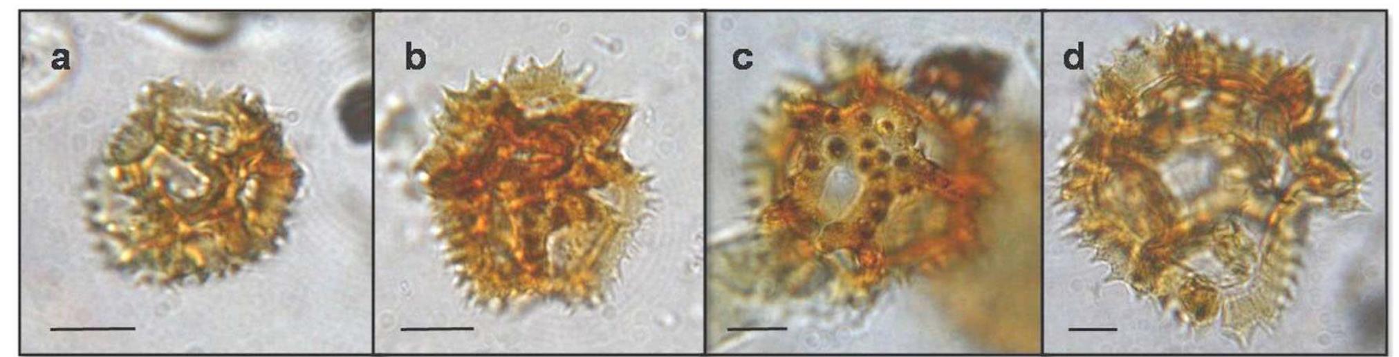 Fig. 1 - Pollen of Cichorieae from archaeological sediment samples. a) Hieracium type (17 um); b) pollen grain of range size 18-25 tum (23 um); c) pollen grain of range size 26-44 um (35 um); d) Scolymus type (54 um). The scale bar is 10 um.  scattered trees and shrubs living quite far from the site. 