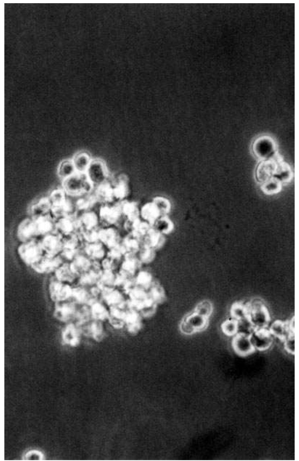 Very Rounded Configuration Cells 3 morphology of epstein-barr virus transformed cells. note