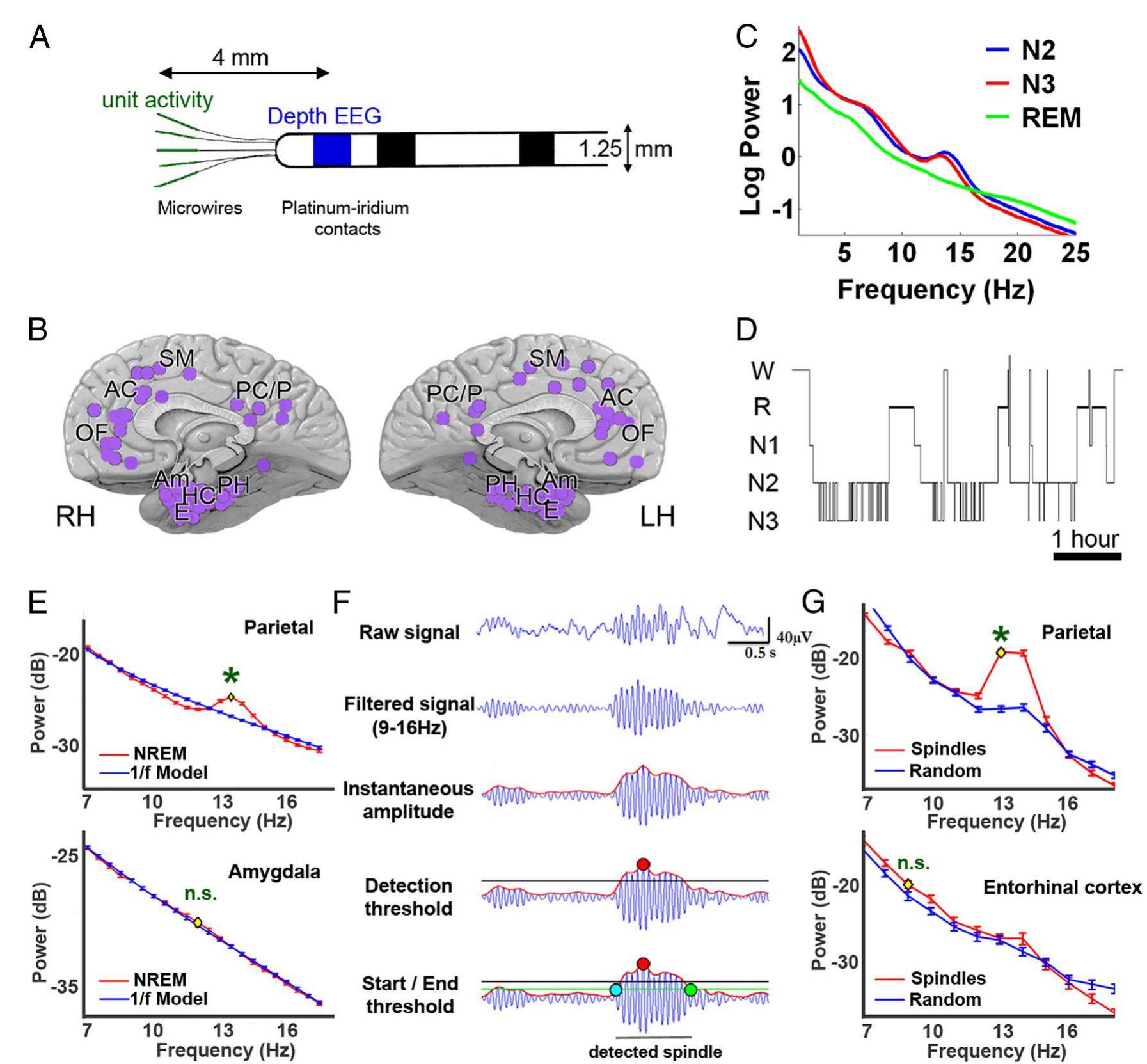 (PDF) Sleep Spindles in Humans: Insights from Intracranial EEG and Unit ...