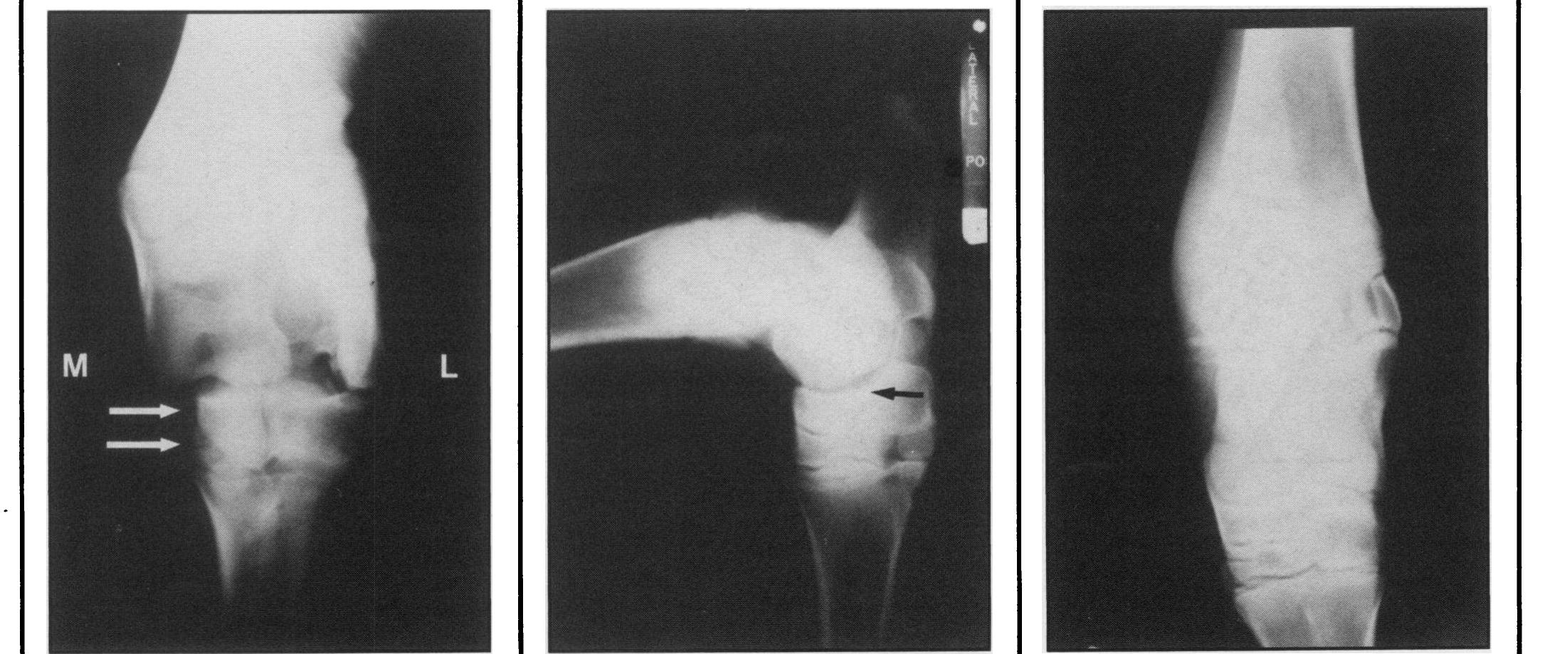 (PDF) Proximal intertarsal subluxation in three holstein-friesian heifers