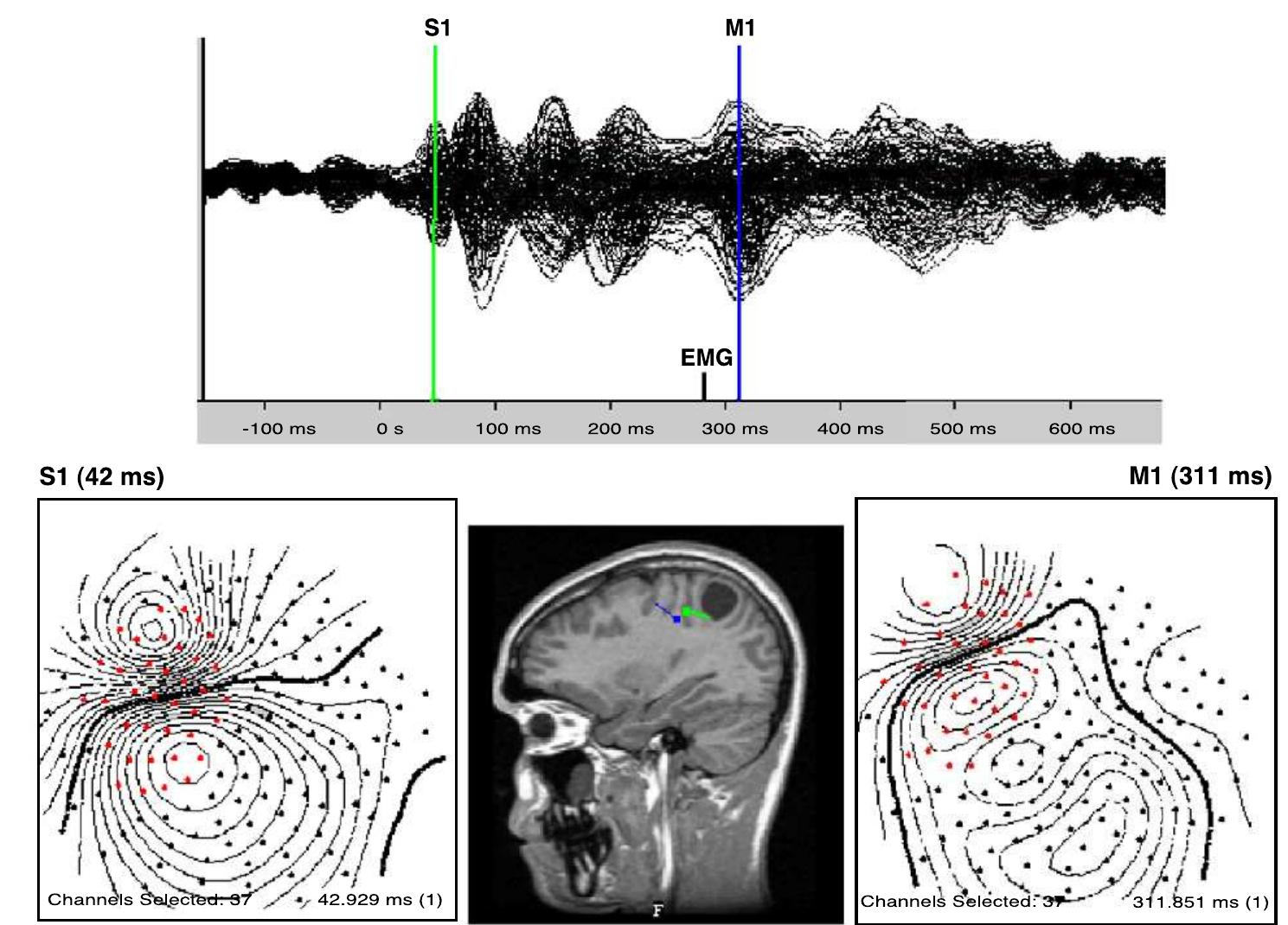 Examples of averaged erf waveforms for a representative
