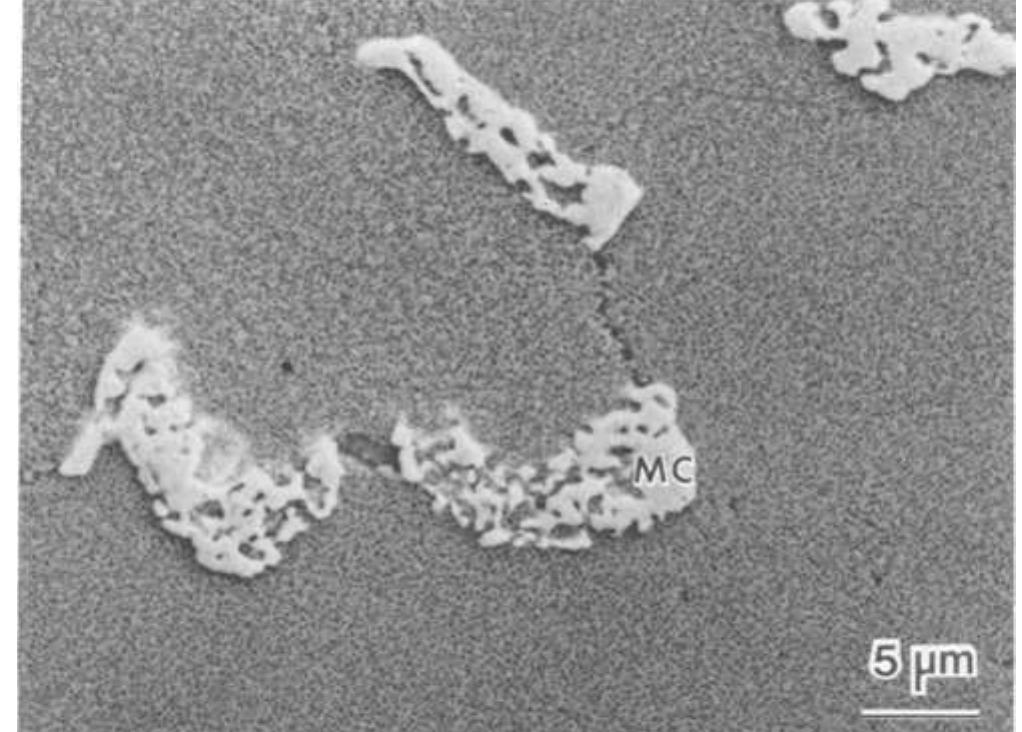 scanning electron micrograph showing the microstructure of