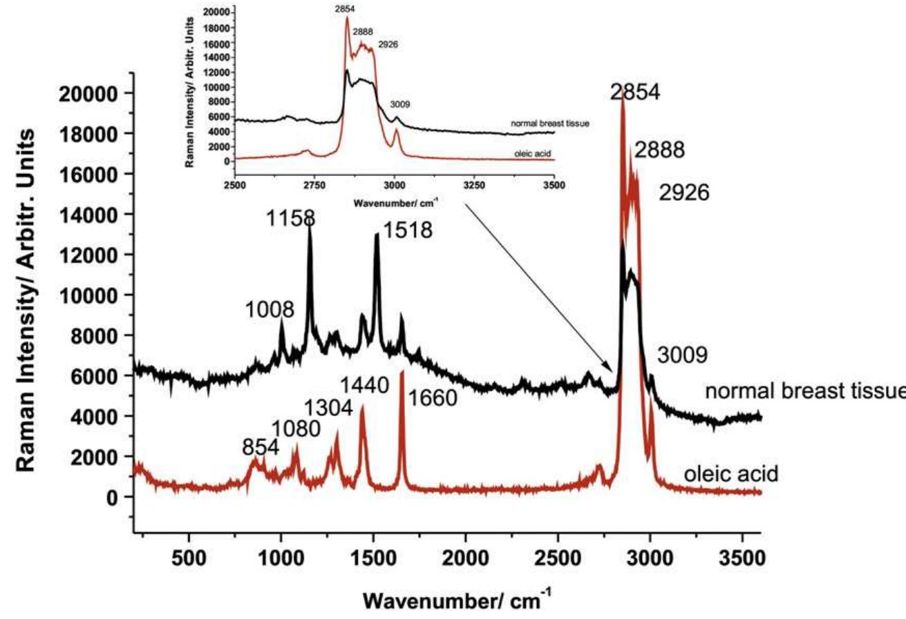 Figure 6 - from The label-free Raman imaging of human breast