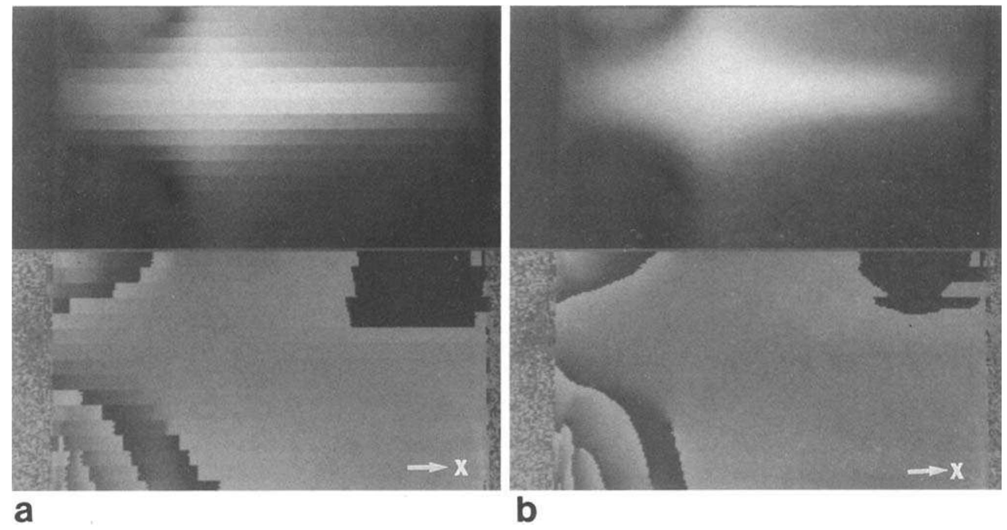 Scanner Interleave (PDF) Interleaved echo planar imaging on a standard MRI system