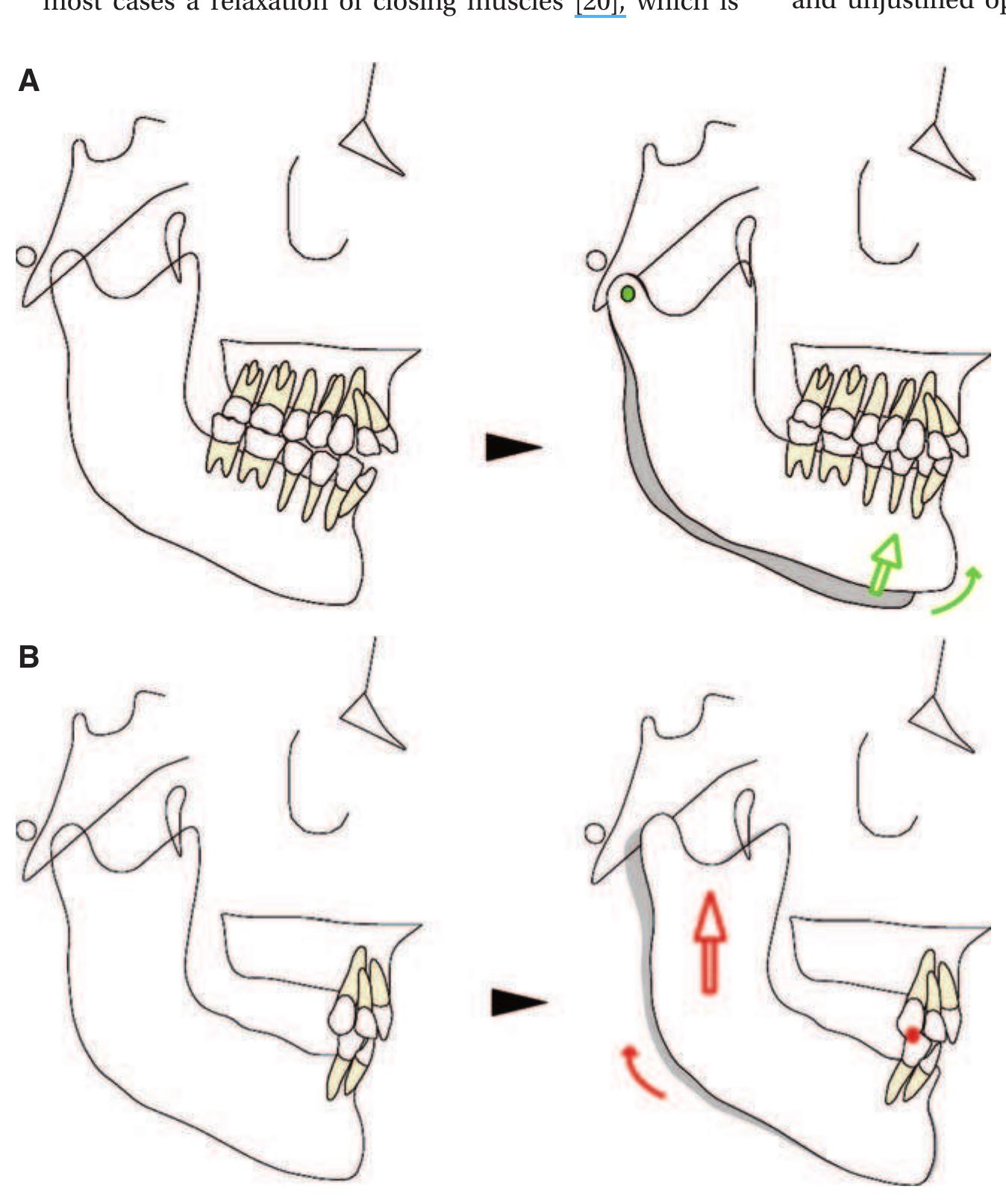 Figure 8 - from Vertical dimension of occlusion: the keys to
