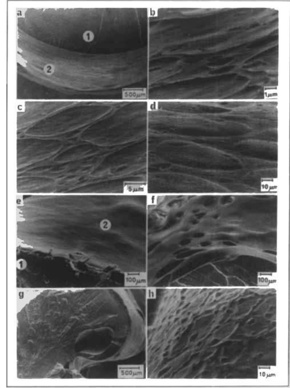 Ure 6. scanning electron micrographs of polyethylene strands