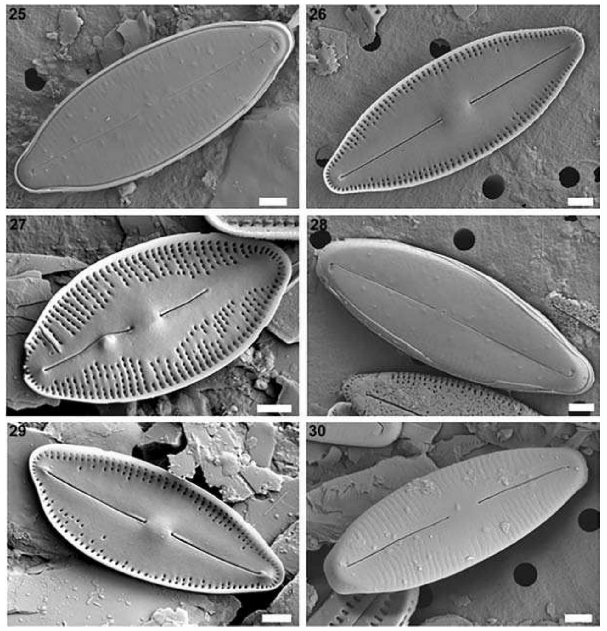 S 25-30. scanning electron microscope images of nupela