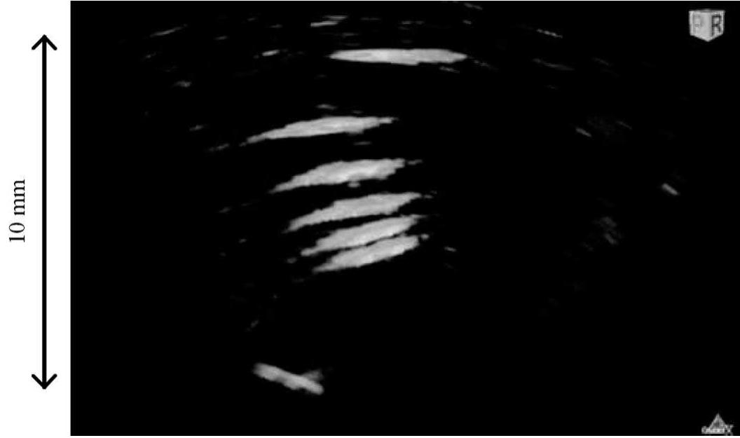 3d-rendered image obtained of the phantom shown in fig. 19.