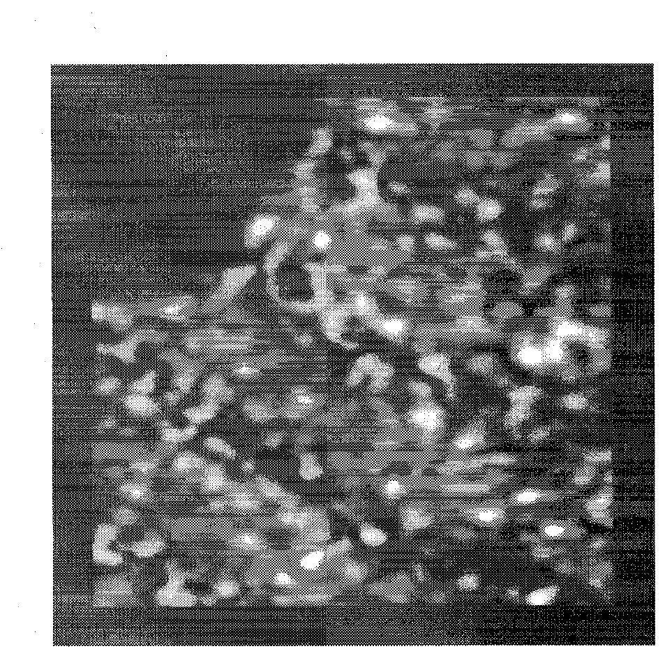 Synthetic echo image with 256 x 256 pixels spatial