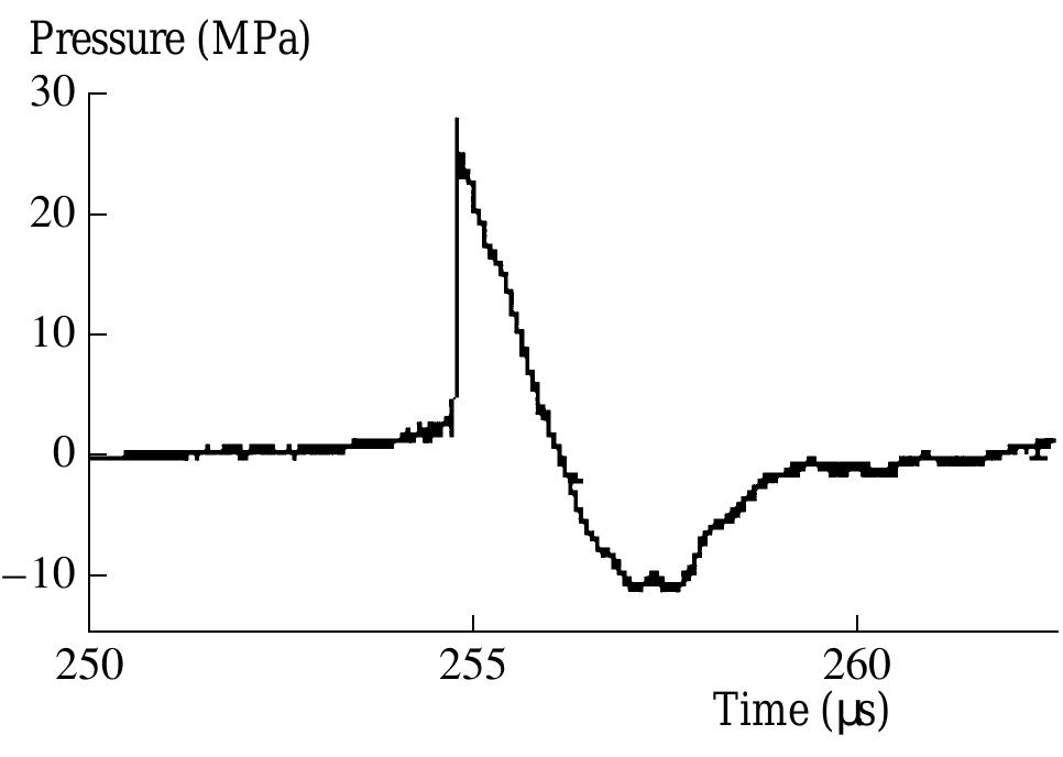 Hifu lesions (left) in transparent gel phantom and b-mode