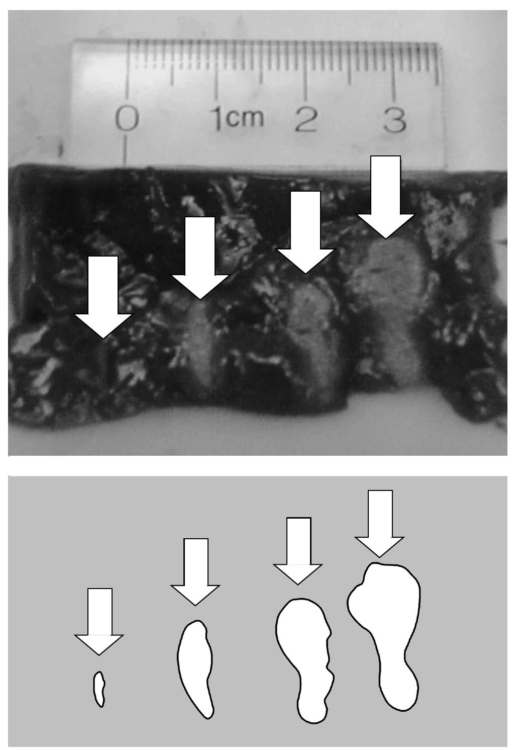 Hifu lesions (left) in transparent gel phantom and b-mode